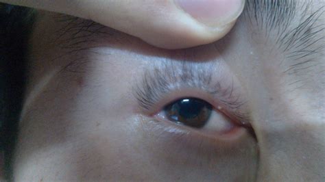 暖氣片有沙眼怎樣堵漏,暖氣片沙眼修復小妙招縮略圖