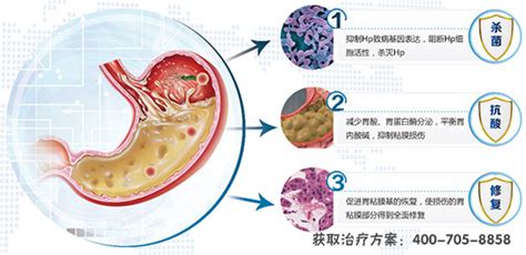 消毒柜能殺死幽門螺桿菌病毒嗎(家用消毒柜能殺滅幽門螺桿菌嗎)縮略圖