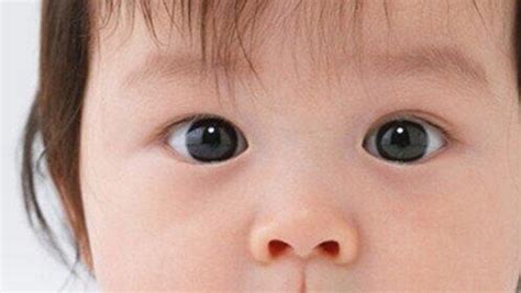 眼睫毛倒著長戳眼睛怎么辦(孩子眼睫毛倒著長戳眼睛怎么辦)縮略圖