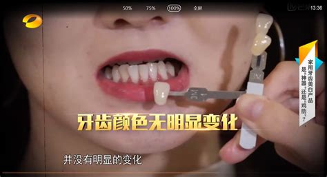 潔牙儀凝膠,潔牙儀凝膠作用縮略圖