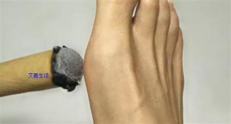 美浮特抗菌凝膠治療疣(美浮特抗菌凝膠治療疣效果怎么樣)縮略圖