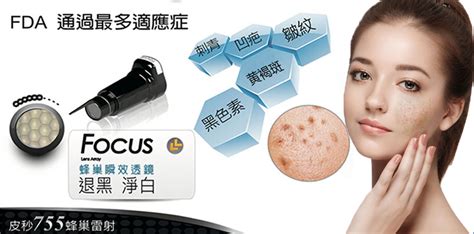祛斑產(chǎn)品對人的危害(祛斑效果最好的排名第一)縮略圖