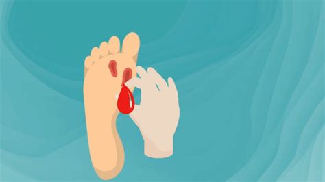 釘子扎了一個小口子要打破傷風嗎(釘子扎個小傷口用打破傷風么)縮略圖