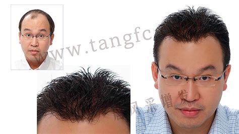假發(fā)男士頭頂發(fā)片,假發(fā)男士頭頂發(fā)片多少錢縮略圖