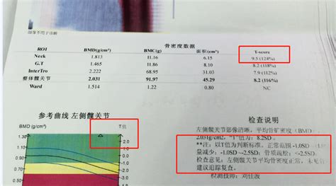 檢測儀上的數(shù)據(jù)怎么看,檢測儀上的數(shù)據(jù)怎么看圖解縮略圖