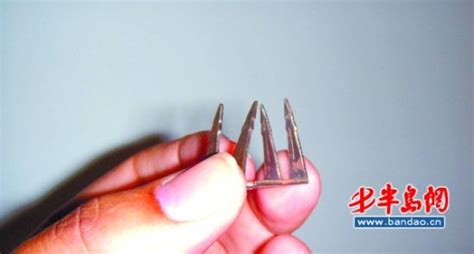 釘子扎腳愈合后長硬塊一碰就疼(釘子扎腳愈合后長硬塊一碰就疼怎么回事)縮略圖