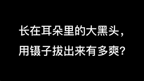 鑷子拔黑頭連根拔起更干凈,用鑷子拔黑頭清除過程縮略圖
