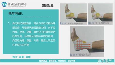 繃帶怎么綁腳踝,繃帶怎么綁腳踝教學縮略圖