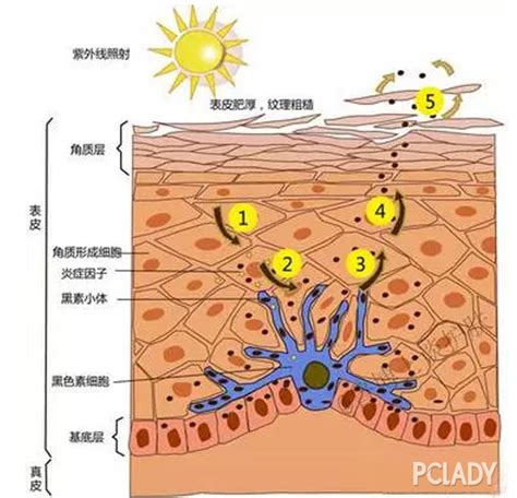 成人色素失調,成人色素失調癥狀縮略圖