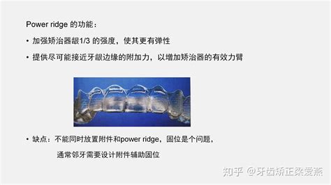 隱形牙套的矯正原理(隱形牙套的矯正原理是)縮略圖