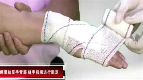 繃帶包扎法(繃帶包扎法六種視頻)縮略圖