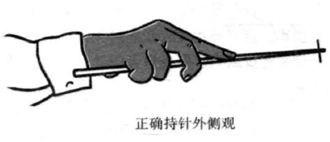 梅花針治療脫發,梅花針治療脫發有用嗎縮略圖