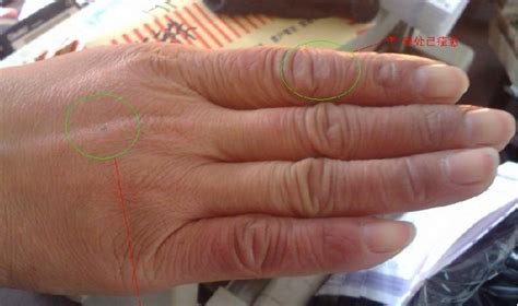 馬油膏治手裂腳裂(馬油膏治手裂腳裂嗎)縮略圖