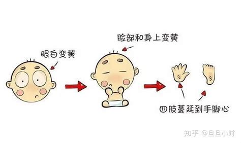 黃梔子洗澡能去小兒黃疸嗎(黃梔子洗澡能去小兒黃疸嗎要洗多少次才可以去黃疸)縮略圖