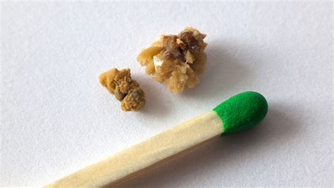 地牯牛能治療腎結石嗎(地牯牛真的能治療腎結石嗎)縮略圖