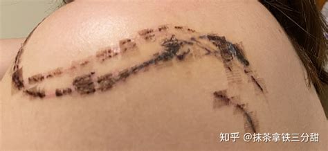 紋身貼能洗掉嗎(半永久紋身貼能洗掉嗎)縮略圖