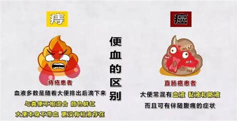 大號出血鮮紅色不痛什么原因,一上大號就流血,血是鮮紅色的縮略圖