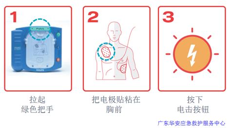 除顫器放置位置圖解,除顫器放置位置圖解視頻縮略圖