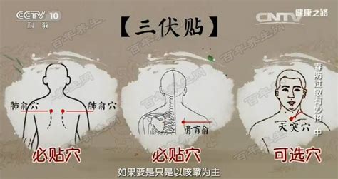 三伏貼貼敷部位圖(三伏貼貼敷部位圖片)縮略圖