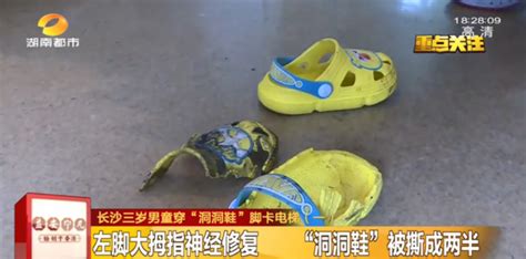 洞洞鞋為什么不能搭扶手電梯(搭電梯為什么不能穿洞洞鞋)縮略圖