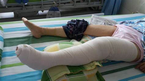 繃帶美人,繃帶美美縮略圖