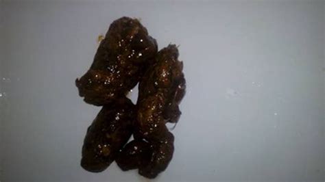 純黑色的屎是什么原因(女性拉黑色大便正常嗎)縮略圖
