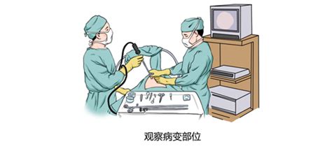 胸交感神經切除術多少錢,交感神經阻斷術多少錢縮略圖