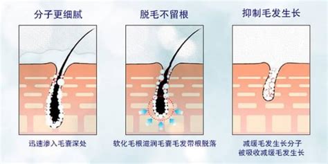 脫毛膏的正確使用方法(脫毛膏的正確使用方法順序)縮略圖