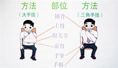 三角巾包扎方法有6種,三角巾包扎方法有6種圖縮略圖