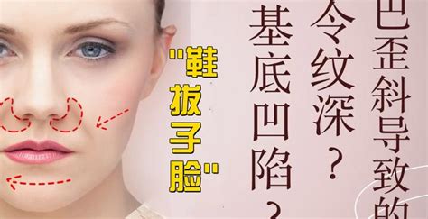 鞋拔子臉怎么矯正(鞋拔子臉怎么矯正多少錢)縮略圖