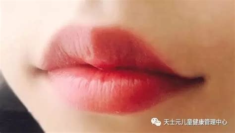 吸嘴唇是什么原因,經常吸嘴唇是怎么回事縮略圖