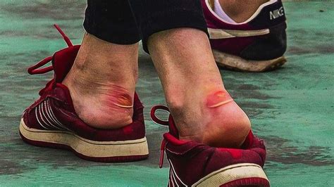 皮鞋磨腳后跟怎么辦(皮鞋磨腳后跟怎么辦小妙招)縮略圖