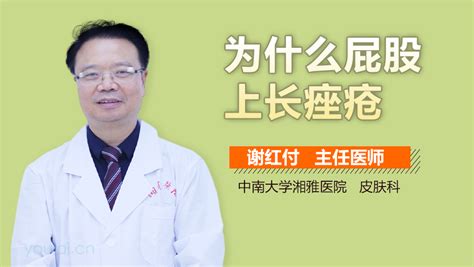 凳子坐久了屁股上長痘痘(凳子坐久了屁股上長痘痘怎么辦)縮略圖
