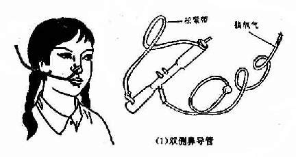 氧氣罐吸氧的操作流程及步驟,氧氣罐吸氧的操作流程及步驟圖片縮略圖
