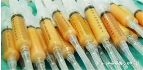 瘦身針有用嗎,瘦身針有用嗎多久見效縮略圖