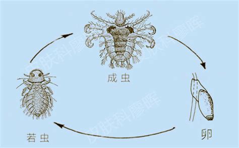 滅蚊器能殺死陰虱嗎,用滅蚊劑能把陰虱殺死嗎縮略圖