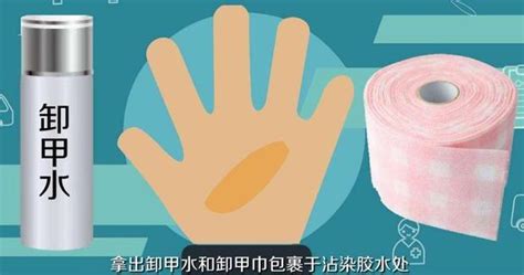 502膠水怎么溶解去除,502膠水怎么溶解去除干凈縮略圖
