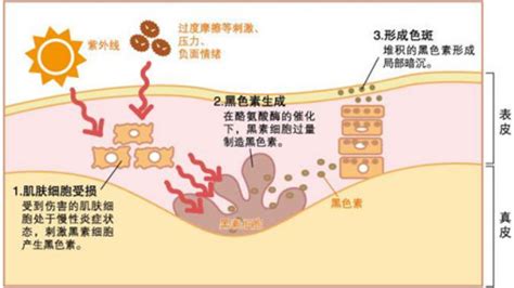 祛斑最好的方法 目前最有效的(祛斑最好的方法目前最有效的30個)縮略圖