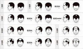 生發(生發洗發水)縮略圖