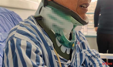 頸膜固定帶第一名直播,脖套護頸直播第一名縮略圖